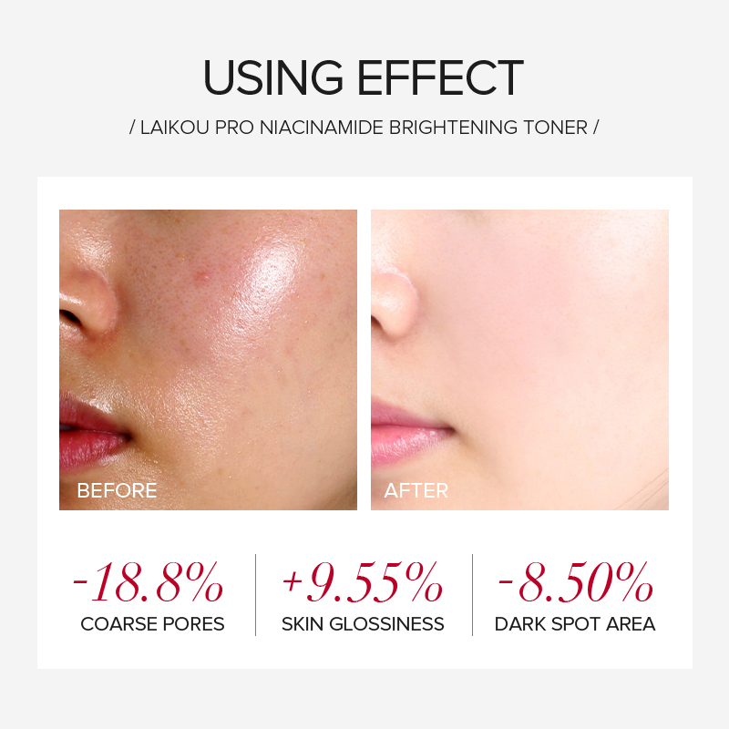 LAIKOU PRO Niacinamide 4 Parça - Skincare Oily Skin incelemesi ve fiyatı