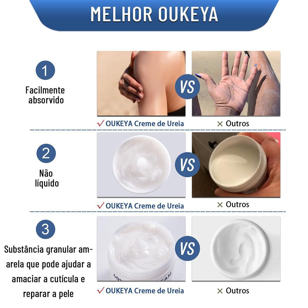 Üre Kremi %40 Nemlendirici Ant - Urea Foot Cream incelemesi ve fiyatı