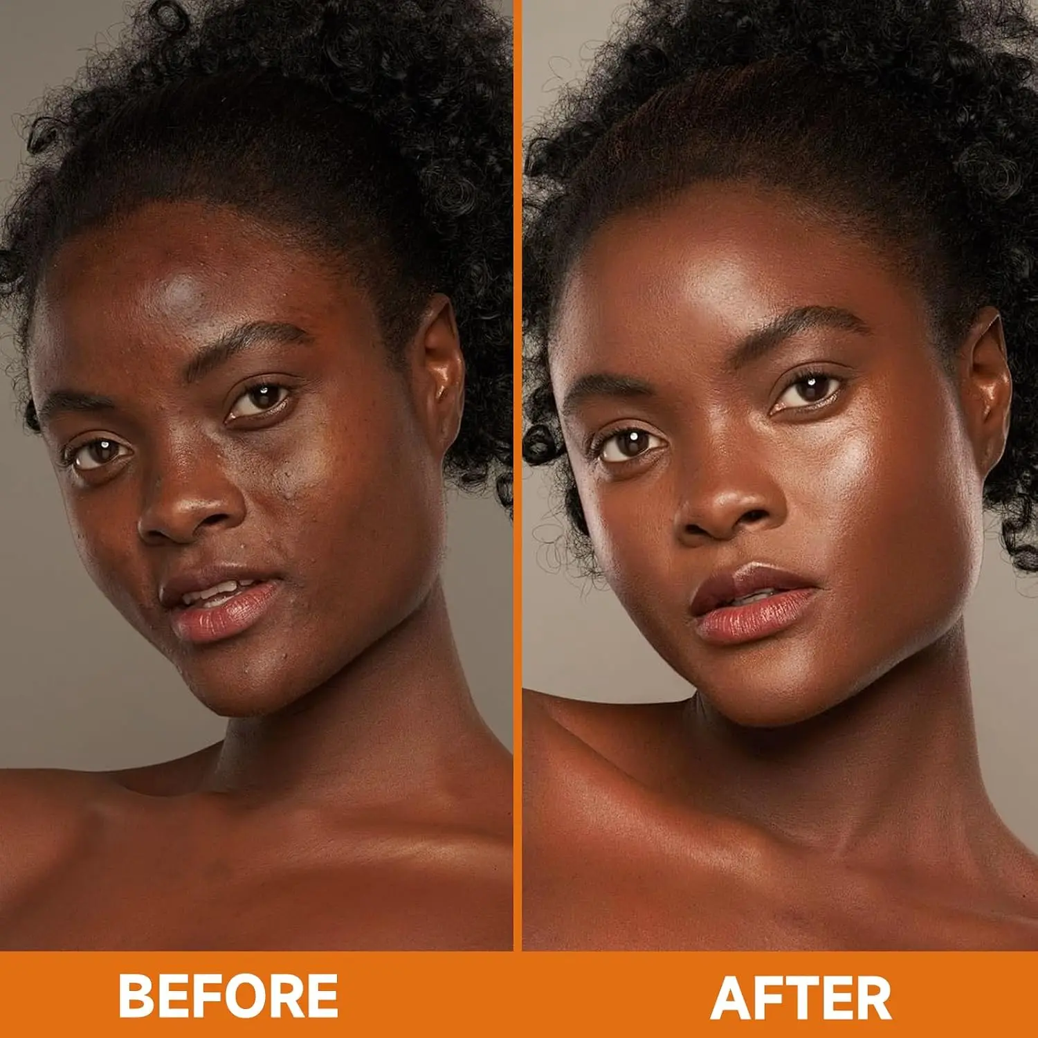 4'lü Paket Zerdeçal Kojik Asit - Skincare Oily Skin incelemesi ve fiyatı