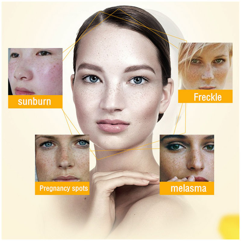 Dimollaure Beyazlatıcı Çil Kre - Skincare Herbal incelemesi ve fiyatı