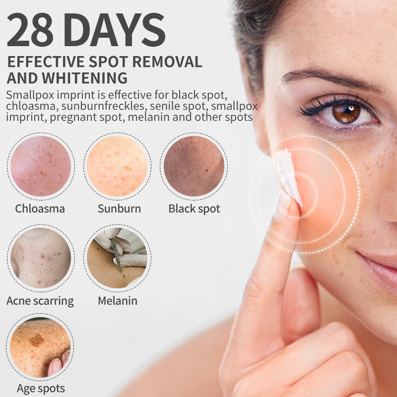 Dimollaure Beyazlatıcı Çil Kre - Skincare Herbal incelemesi ve fiyatı
